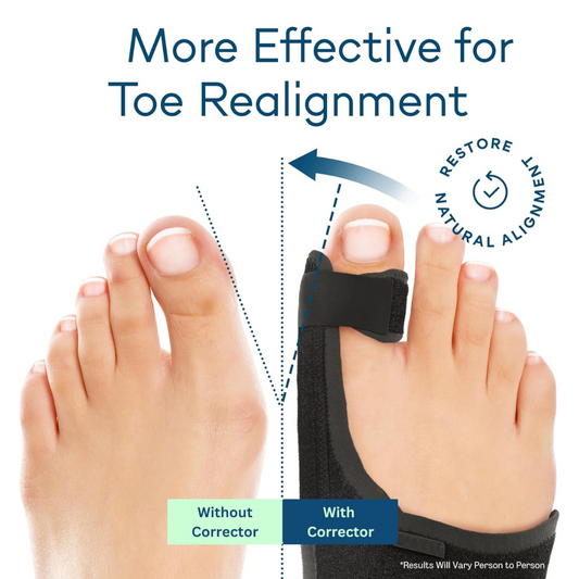 Hyggear Adjustable Day And Night Use Toe Fixed Strap (with Built-in Aluminum Strip)